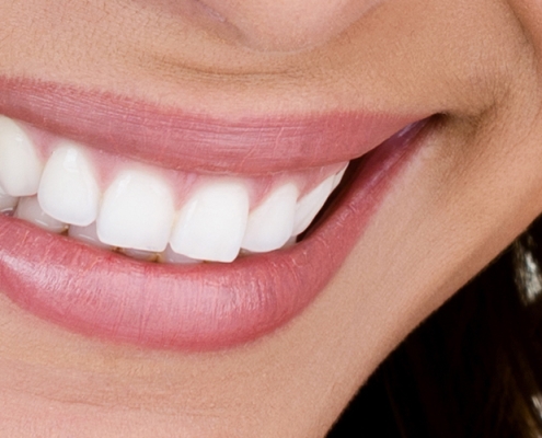 Woman_Smiling_Teeth_Whitening